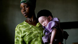 In the Shadow of the Sun